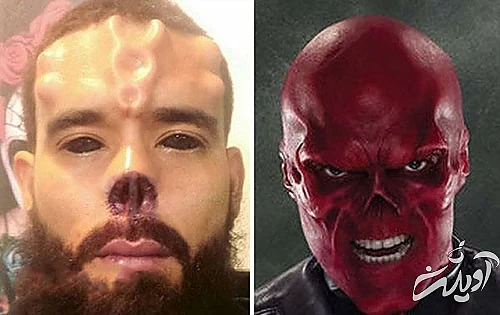 عجیب‌ترین و مضحک‌ترین جراحی‌های زیبایی